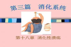 消化性溃疡ppt
